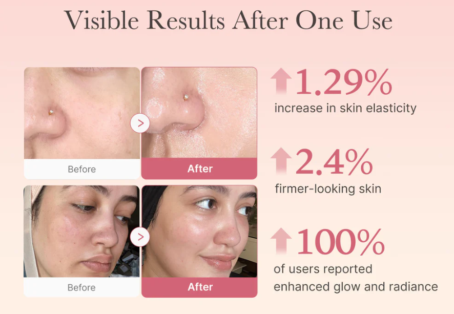 Medicube Collagen Jelly Cream – Moisturizing & Elasticity Boost